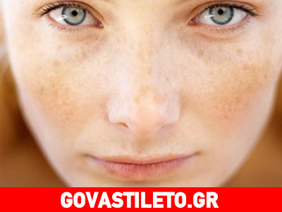 Ποια είναι η «μάσκα της εγκυμοσύνης»;